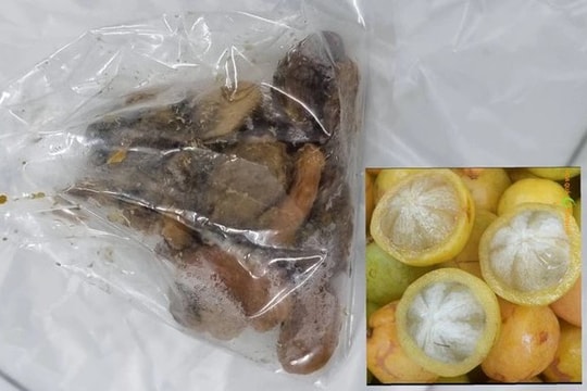 Một người phụ nữ bị thủng ruột do ăn măng cụt rừng không bỏ hạt