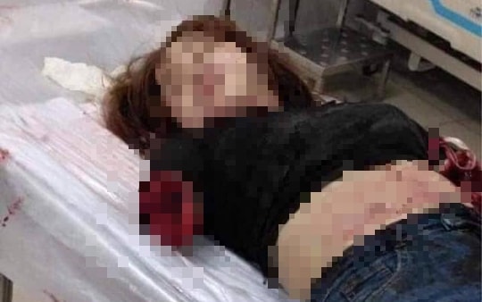 Vụ chồng chém vợ ở Đồng Nai: Người nhà yêu cầu bệnh viện giữ kín mọi thông tin