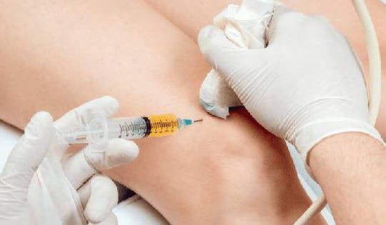 Viêm khớp - Những hiểm họa sau tiêm thuốc vào khớp