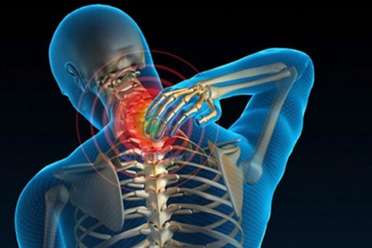 Phương pháp điều trị và phòng ngừa thoái hóa đốt sống cổ