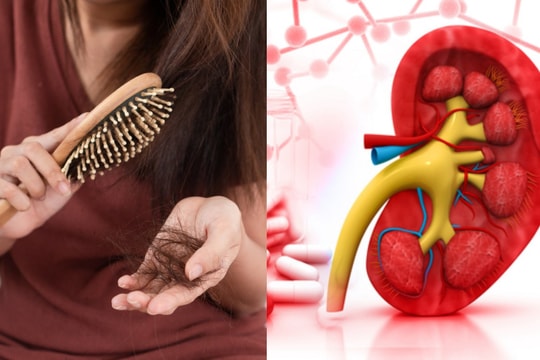 5 dấu hiệu vào buổi sáng cảnh báo thận có vấn đề bạn không nên chủ quan bỏ qua