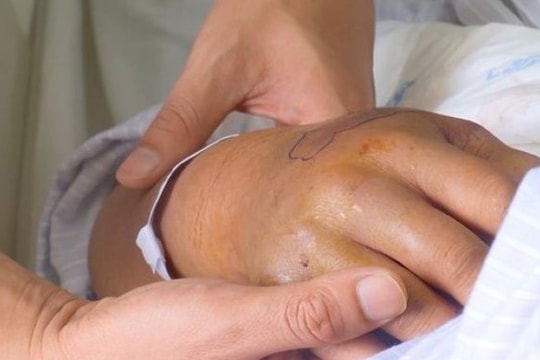 Cảnh báo nhiều trường hợp nguy kịch do tự ý đắp lá trị rắn cắn