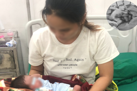 Nghệ An: Cứu sống bé sinh non, nội tạng nằm ngoài ổ bụng