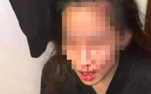 Quảng Ninh: Chồng đánh vợ đang mang bầu rồi phát trực tiếp trên Facebook