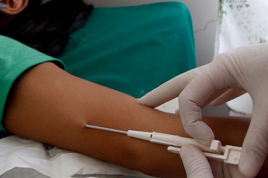Cấy que tránh thai gây vô kinh có nguy hiểm không?