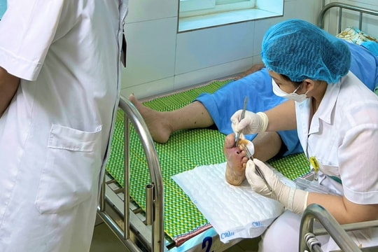 Người đàn ông phải tháo bỏ ngón chân vì tự ý đắp lá vào vết loét