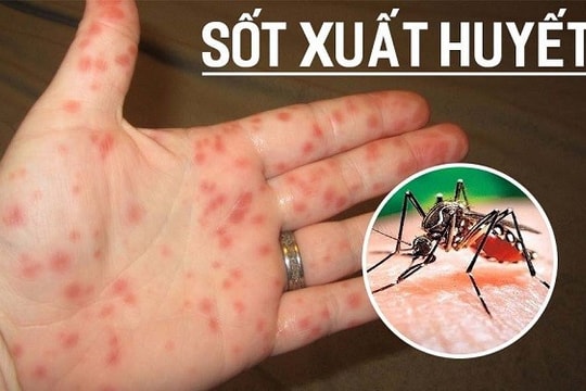 Đồng Tháp: Đã có 12 trường hợp tử vong do sốt xuất huyết