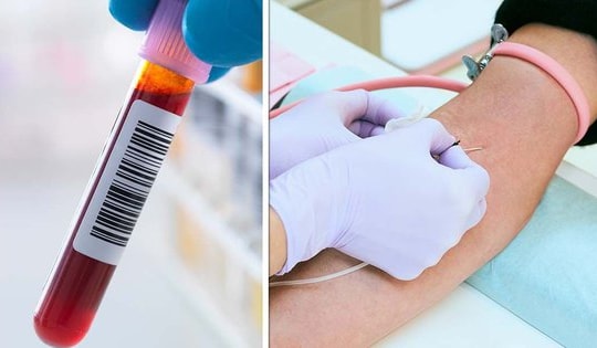 9 xét nghiệm máu quan trọng nên thực hiện hàng năm