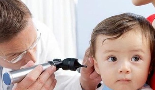 Viêm tai giữa cấp mủ ở trẻ và những điều cần biết