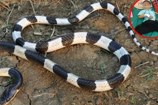 Cứu sống bé trai 5 tuổi nguy kịch vì bị rắn cạp nia cắn