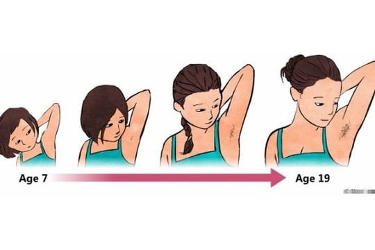 Dậy thì sớm gia tăng, phương pháp nào để điều trị?