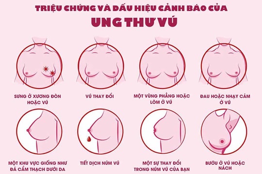 Bệnh viện Chợ Rẫy khám tầm soát ung thư vú miễn phí