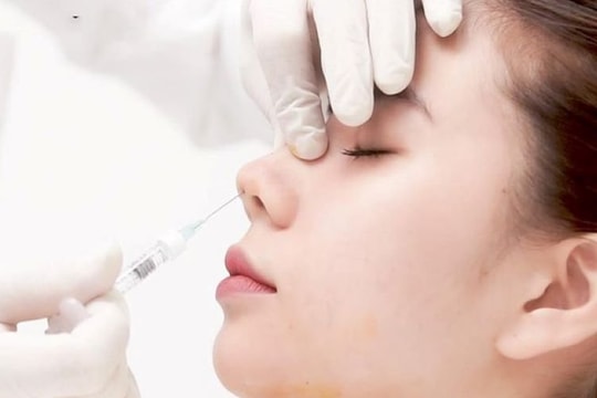 Bác sĩ cảnh báo những biến chứng sau tiêm filler nâng ngực, mũi, xóa nhăn… 