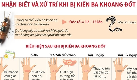 Nhận biết và xử trí khi bị kiến ba khoang đốt