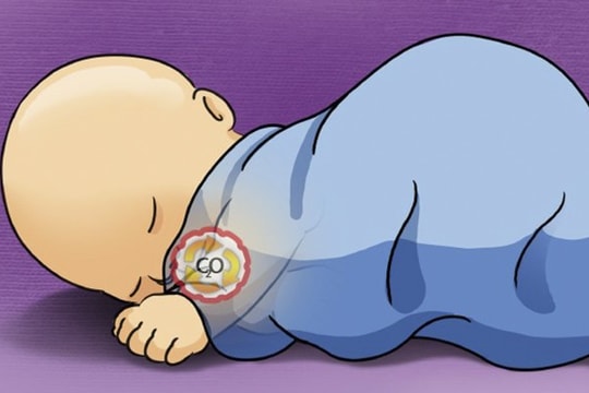 Cảnh báo hội chứng đột tử ở trẻ sơ sinh