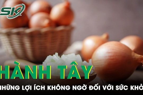 Hành tây có tác dụng gì đối với sức khỏe?