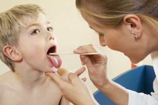 Cần làm gì khi trẻ bị viêm họng nhưng không ho