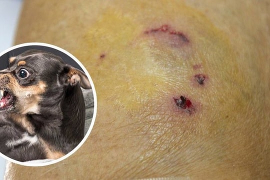 Hà Nội: Người đàn ông tử vong sau 2 tháng bị chó cắn