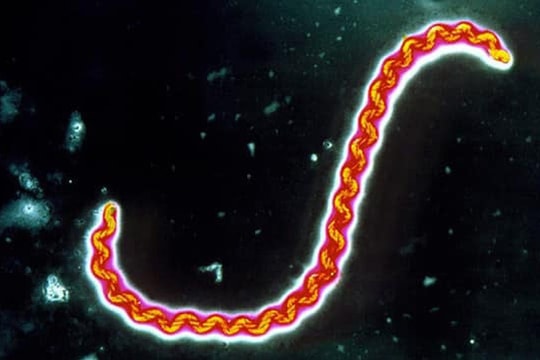 Bà Rịa - Vũng Tàu: Ghi nhận 2 trường hợp nhiễm xoắn khuẩn vàng da