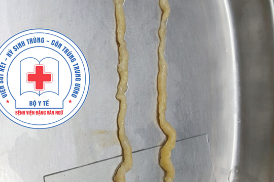 Nhiễm sán dây do thói quen ăn thịt bò tái, rau sống