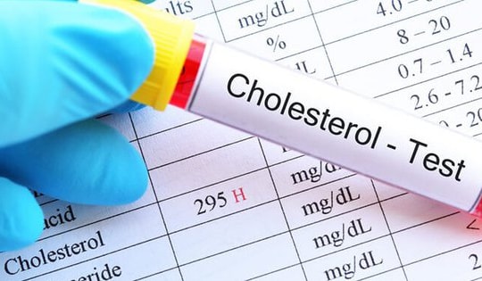 Quy trình xét nghiệm máu nhiễm mỡ và những lưu ý