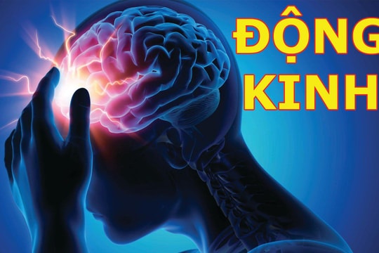 COVID-19 có thể tăng nguy cơ co giật và động kinh