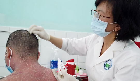 Nhiều trường hợp nhập viện do sử dụng thuốc chữa vảy nến trên mạng