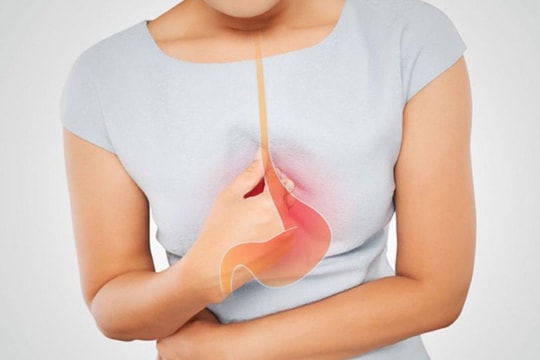 Trào ngược dạ dày - thực quản: Có nên kiêng đồ ăn nhiều chất béo?