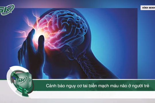 Tai biến mạch máu não gia tăng ở người trẻ: Làm thế nào để phát hiện sớm?
