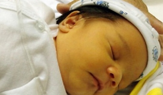 Cách phát hiện bệnh vàng da ở trẻ sơ sinh trong mùa đông