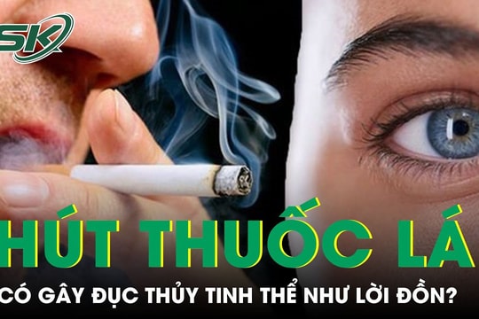Thực hư thông tin hút thuốc lá gây đục thủy tinh thể