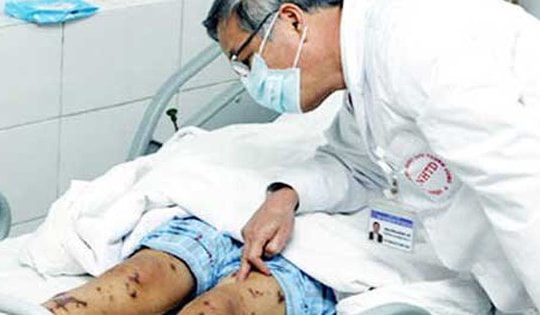 Đã có bệnh nhân nhiễm liên cầu lợn ở người, Bộ Y tế yêu cầu tăng cường giám sát, phát hiện sớm