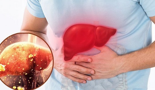 Điểm mặt những thực phẩm tồi tệ nhất cho sức khỏe lá gan