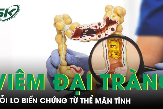 Viêm đại tràng mạn tính và nỗi lo biến chứng