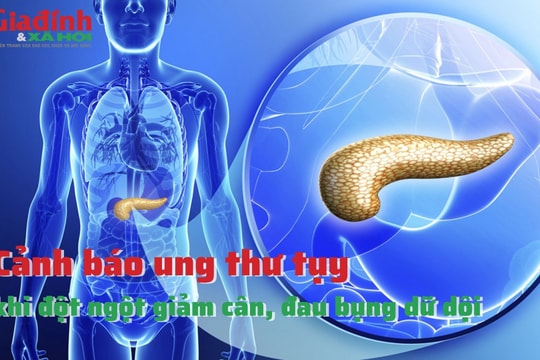 Cảnh báo ung thư tụy khi đột ngột giảm cân, đau bụng dữ dội