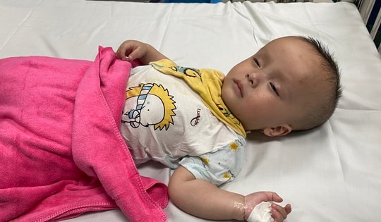 Bé 3 tuổi bị não úng thủy phải nhập điều trị tiếp