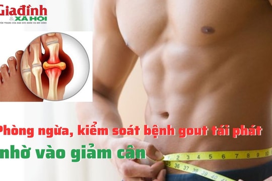 Phòng ngừa, kiểm soát bệnh gout tái phát nhờ vào giảm cân