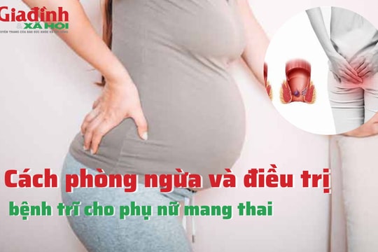 Cách phòng ngừa và điều trị bệnh trĩ cho phụ nữ mang thai