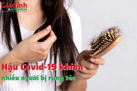 Hậu COVID-19 khiến nhiều người bị rụng tóc