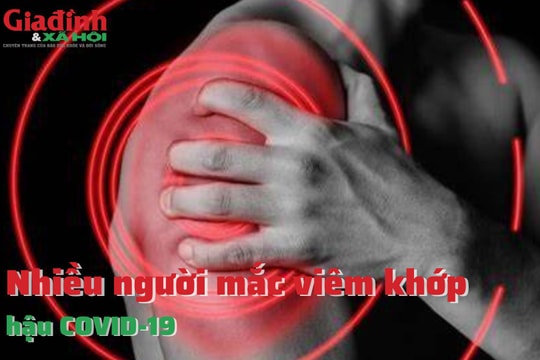 Nhiều người mắc viêm khớp hậu COVID-19