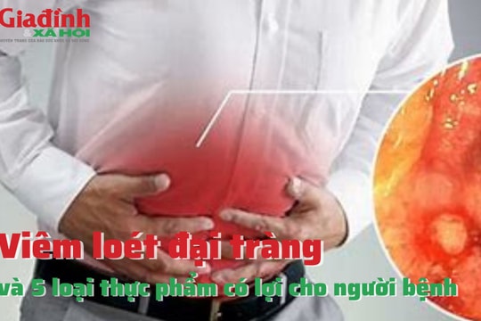 5 loại thực phẩm vô cùng có lợi cho người bị viêm loét đại tràng