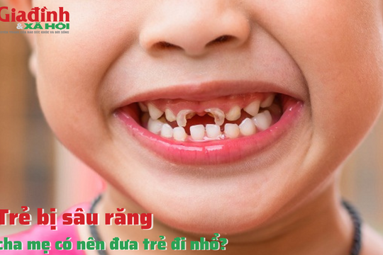 Trẻ bị sâu răng, cha mẹ có nên đưa trẻ đi nhổ?