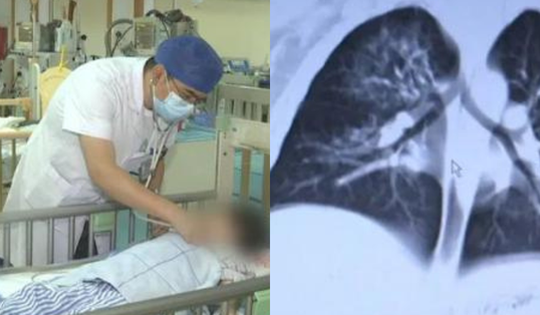 Bé trai 2 tuổi chứa hơn 10 loại vi khuẩn trong phổi, bác sĩ chỉ ra nơi là "ổ mầm bệnh" trong nhà nhưng ít người để ý lau dọn