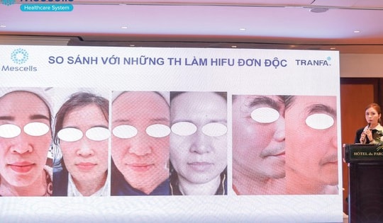 Workshop 2023 với chủ đề “Centerless Focused Ultrasound - Công nghệ sóng siêu âm hội tụ đến từ Châu Âu