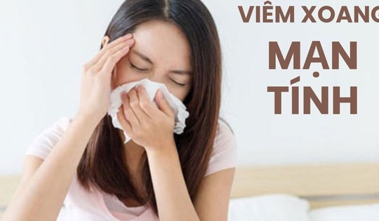 Viêm xoang mạn tính: Triệu chứng và cách cải thiện hiệu quả