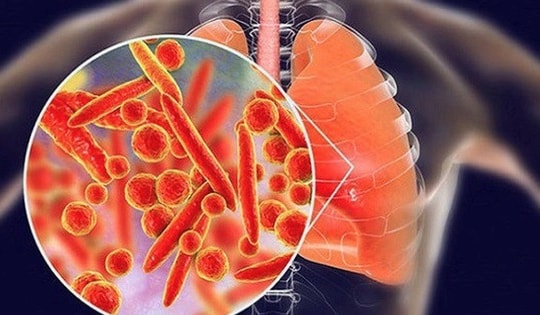 5 nhóm thực phẩm làm sạch phổi, tốt cho đường hô hấp, mùa đông nên ăn thường xuyên