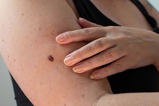 5 tín hiệu cảnh báo ung thư ở người trung niên, người già