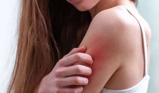 Thiếu hụt 5 dưỡng chất khiến da dễ khô nẻ