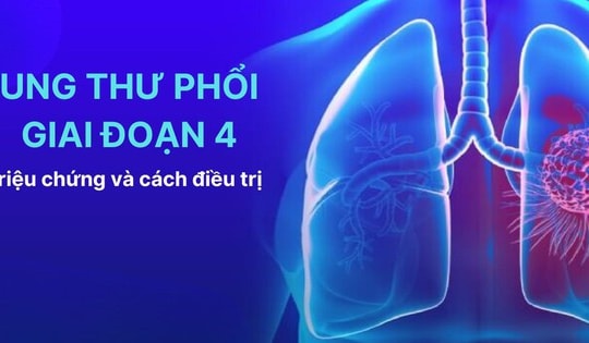 U phổi là gì? Triệu chứng và cách cải thiện