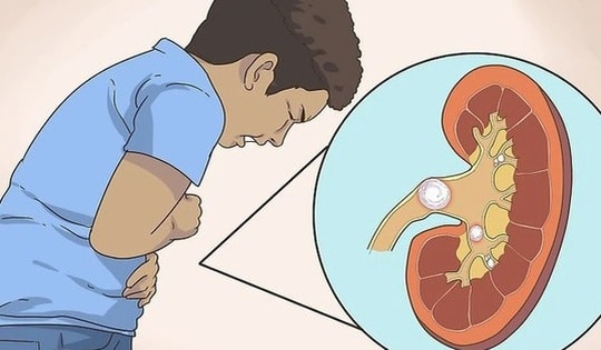 Tăng cân, bé 5 tuổi đi khám bất ngờ phát hiện thận hư, bác sĩ chỉ rõ trẻ có 4 dấu hiệu này cần được khám sớm!